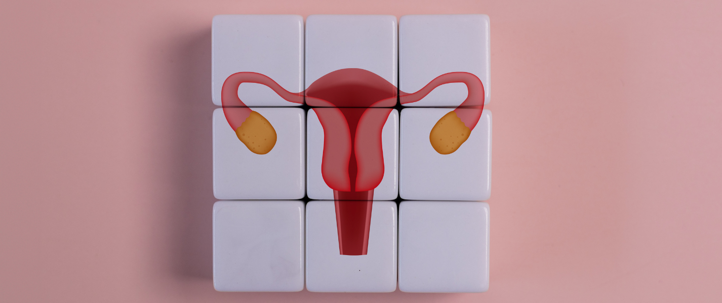 PMOS: A Broader Understanding of Ovarian & Metabolic Health