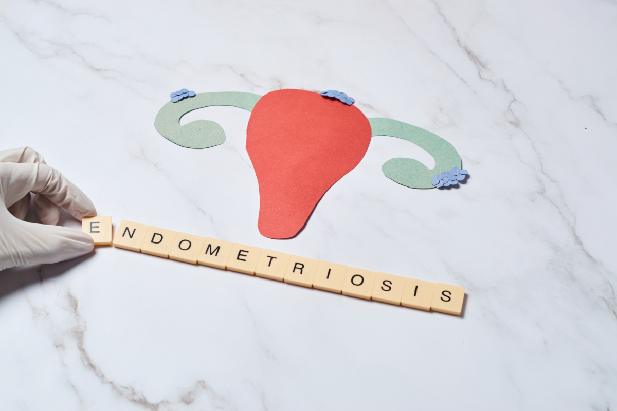 Endometriosis