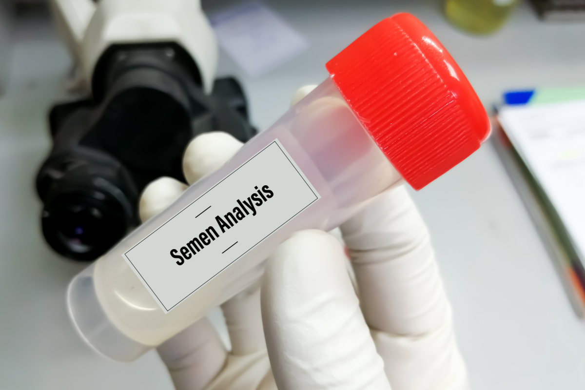 Understanding Your Semen Analysis: What the Results Mean and How to Improve Them